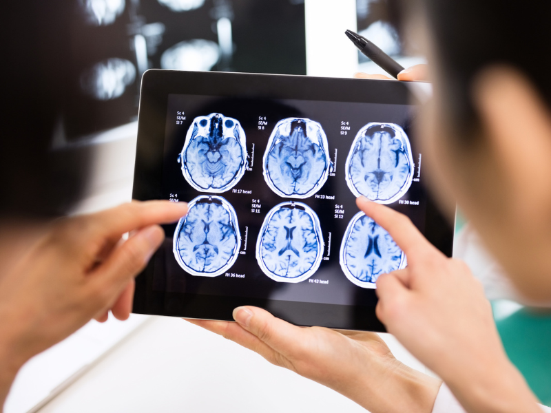 UMMC neurosurgeons are providing pre-and post-surgical care at the Hattiesburg Clinic, providing care closer to home for south Mississippians.