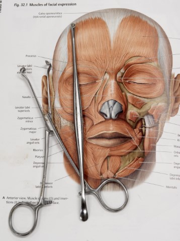 Fig. 32.1 Muscles of facial expression