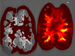 A fluorescent tag allows Chade and Bidwell to view VEGF-ELP accumulation in the kidney on the right. The left kidney did not receive the treatment. (Photo courtesy of A. Chade)