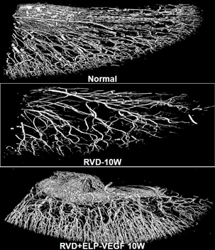 Vessel formation in healthy (top), RVD damaged (middle), and VEGF-ELP treated (bottom) kidneys. (Image courtesy of A. Chade)