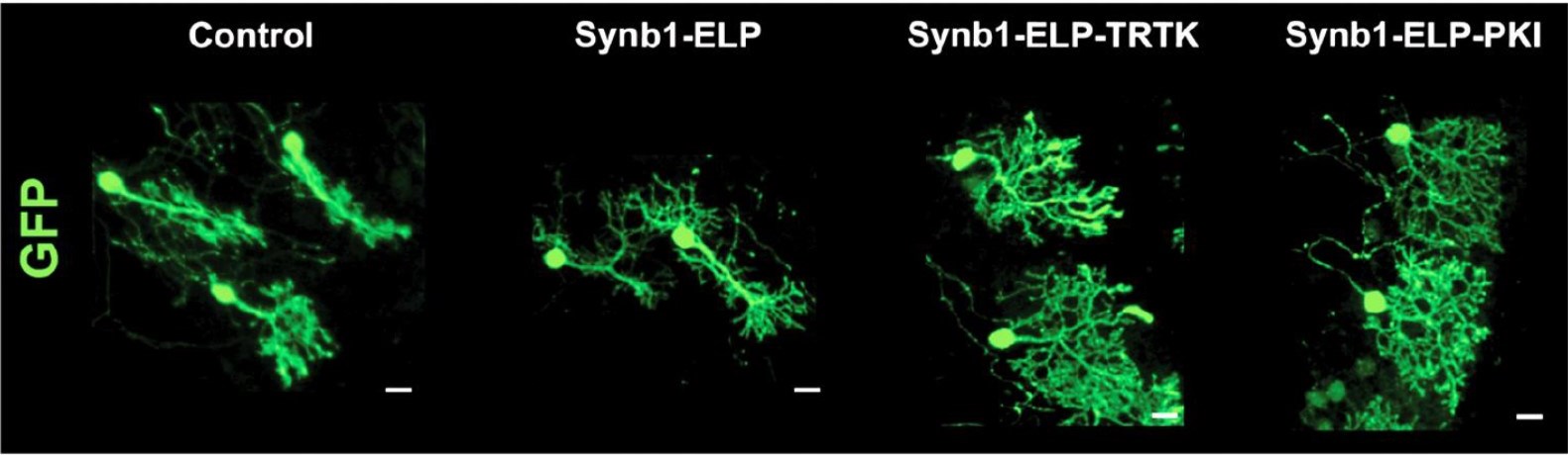 Purkinje neurons affected by SCA1 lose their branches (control). ELP on its own doesn't fix the damage (Synb1-ELP), but when a therapeutic is attached (TRTK and PKI), the neurons recover.
