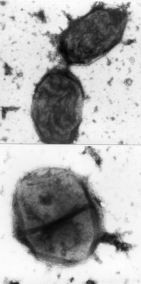 Haemophilus influenza as viewed under a microscope.