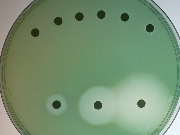 Pseudomonas aeruginosa colonies grow on a cell culture plate.