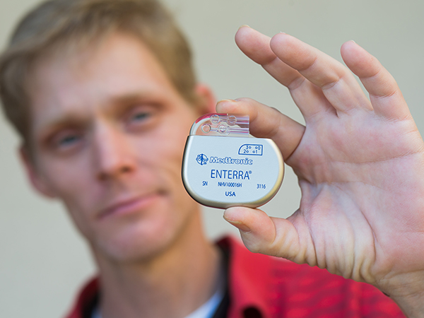 Schickel displays a model of the gastric stimulator recently implanted in his stomach wall.