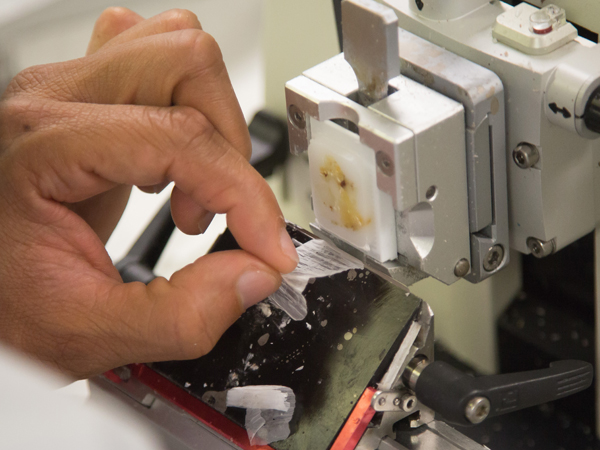 Histotechnologist Damien Roland slices a tissue sample to a thickness of only four microns.