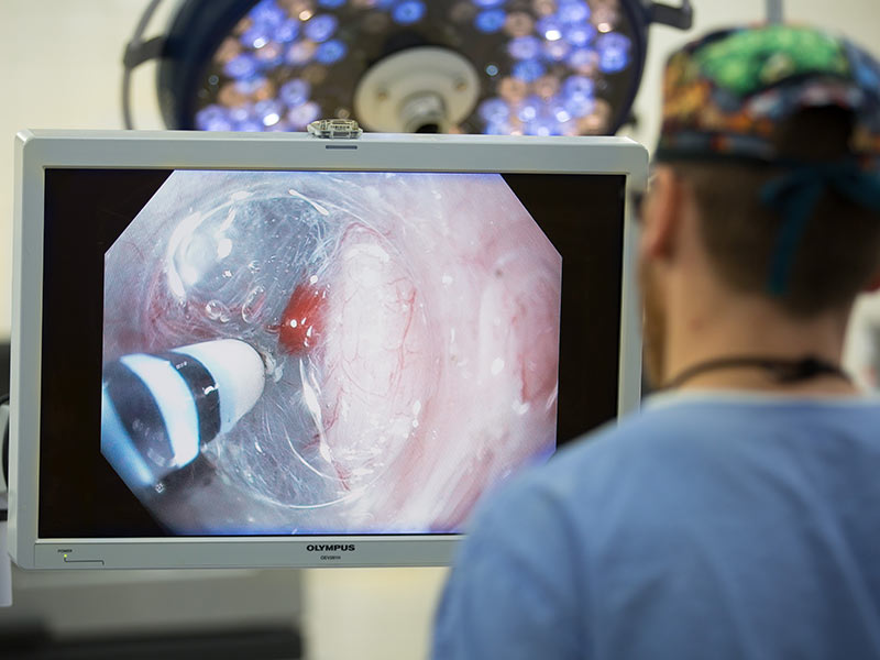 Moremen examines an obstruction on a patient's esophagus during a POEM surgery.