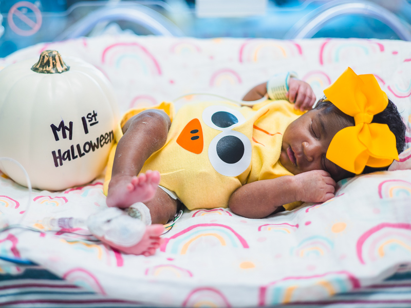 Children's of Mississippi patient Ja'Moni Redd of Jackson naps during her first Halloween. Lindsay McMurtray/ UMMC Communications