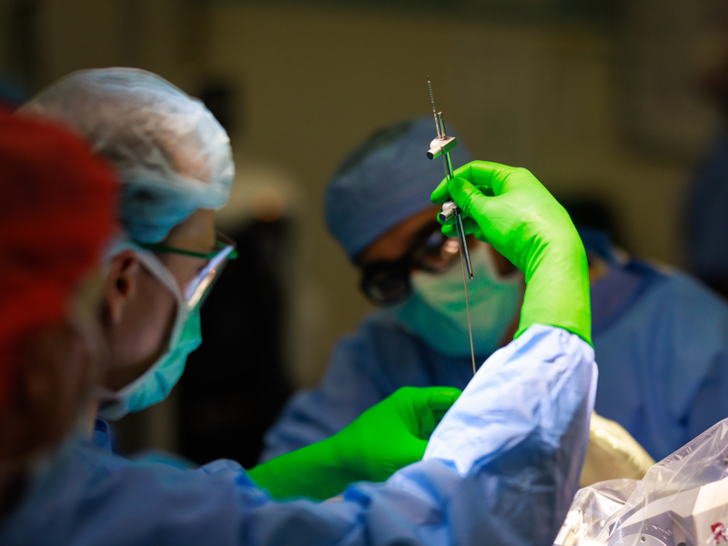 Deep brain stimulation could provide relief for patients with drug-resistant epilepsy.