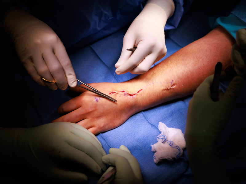 Hand-Surgery.png