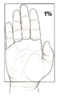 An illustration of the palm, indicating that its surface is equivalent to one percent of the total body surface area.