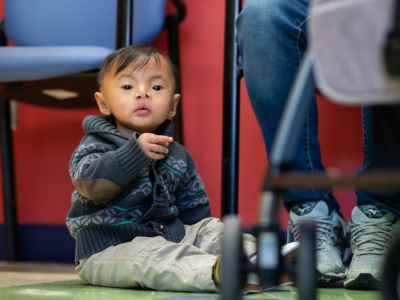 A child with a repaired cleft palate sits on the floor at the clinic.