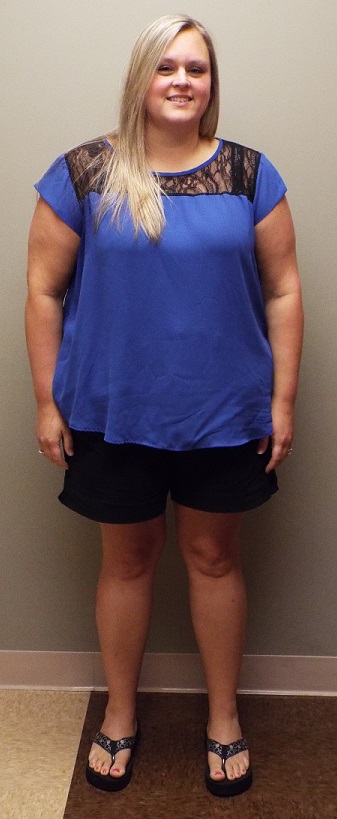 Before her bariatric surgery, Chanci Stewart of Ridgeland weighed about 290 pounds. Today, her weight is 150.