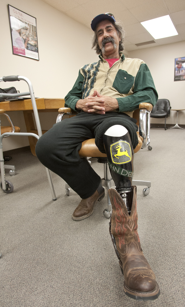 Hattum shows off his John Deere-themed leg