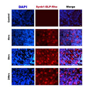 Vig and Raucher's ELP drug delivery system (red) accumulates in the cerebellum (blue) over a 24 hour period. This allows the therapeutic peptide to work on neurodegenerative diseases such as SCA.