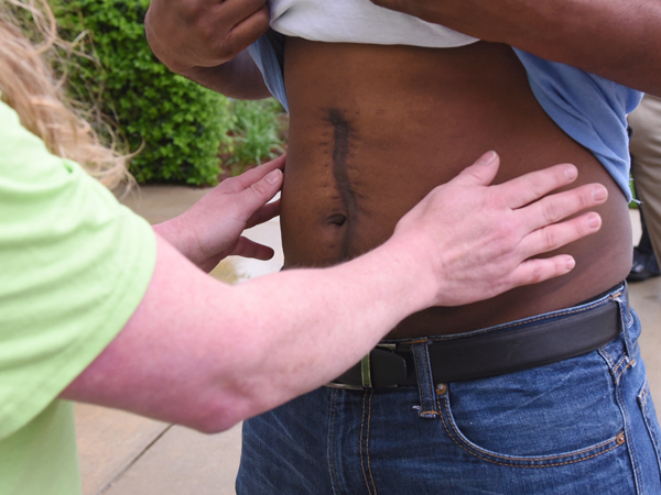 Jordan gently touches the abdomen of Walker, who received her son's kidney and pancreas.