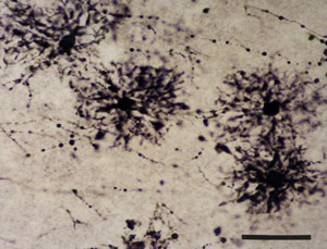 Microscope image of astrocytes (dark) in the hippocampus.
