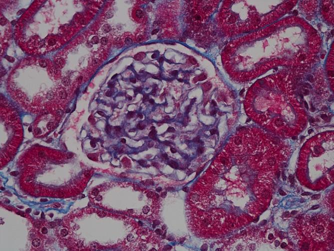 Glomerulus in Dahl SS rat after sildenafil treatment. The smaller size compared to the control indicates improved kidney function.
