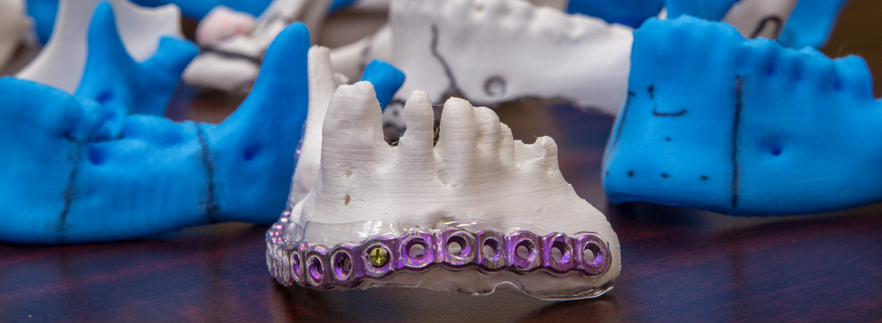 Display of various 3D printed jaws, one with implant attached.