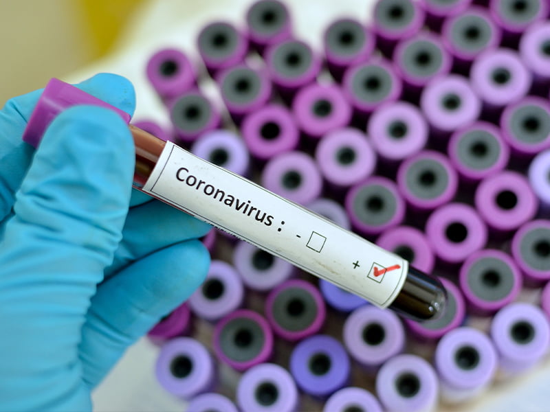 Blood sample with respiratory coronavirus positive