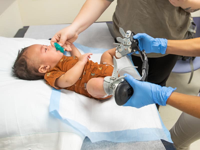 Children&#39;s of Mississippi treatment for clubfoot starts before birth -  University of Mississippi Medical Center