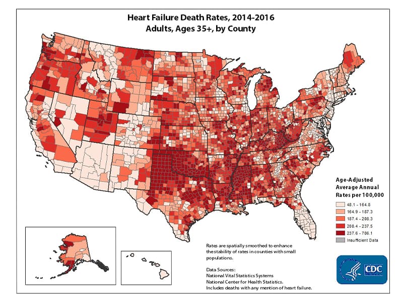 Mississippi has one of the highest heart failure death rates in the United States.