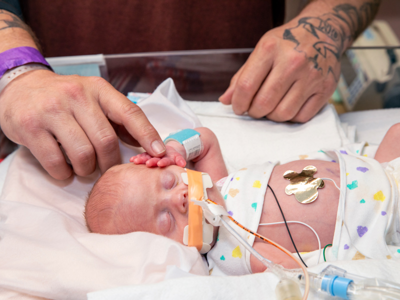 Jason Bedell touches the hand of his son, Sammy Garrett. Sammy had a heart catheterization about a day before.