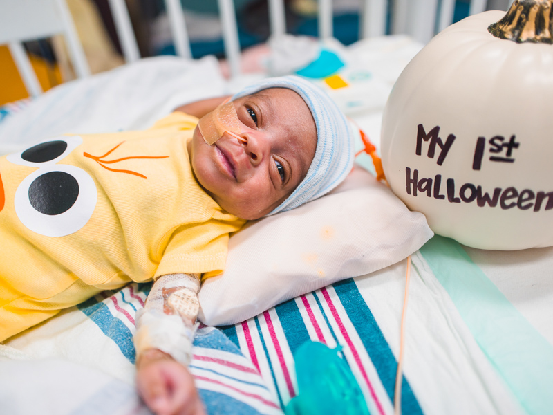 Children's of Mississippi patient Alexander Matthew Gibson shows his chick costume. Lindsay McMurtray/ UMMC Communications