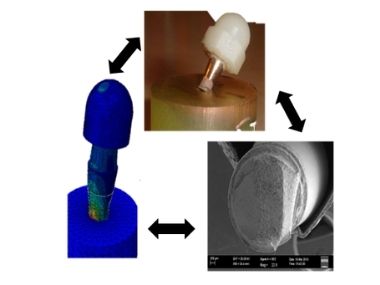 Illustration of implant system